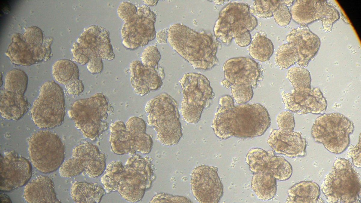 Los organoides de riñón producidos en serie abren la vía a mejorar los trasplantes