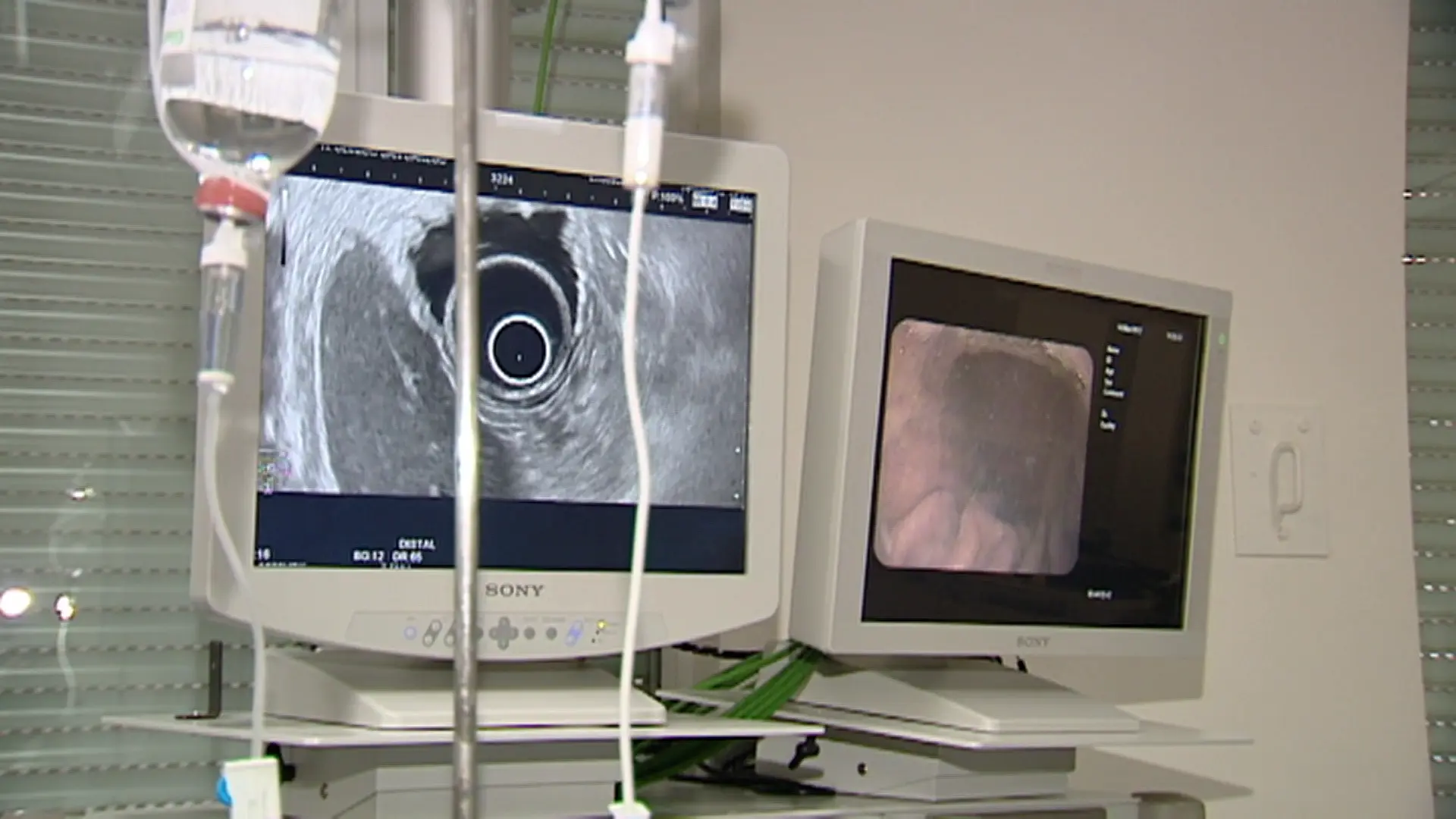 Madrid admite una incidencia en el envío de resultados de cribado de cáncer a 500 personas