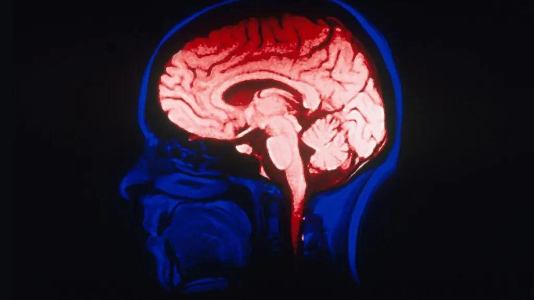 Miles millones de euros, cientos de científicos y Barack Obama: así es el proyecto BRAIN para descifrar el cerebro humano